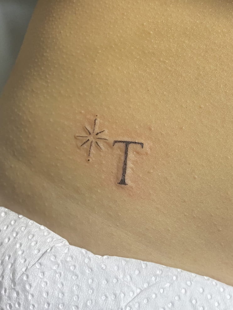 Ejemplo de tatuaje con signos de inflamación excesiva que requiere atención